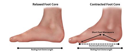 4 Exercises To Improve Foot Strength 𝗣 𝗥𝗲𝗵𝗮𝗯