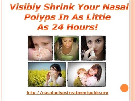 Are Nasal Polyps Cancerous