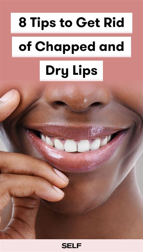 Tips To Get Rid Of Chapped Lips In Chapped Lips Remedy Chapped Lips Dry Lips Remedy
