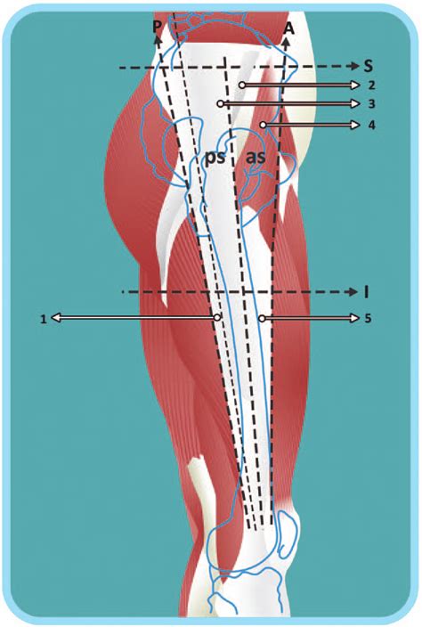 Gluteal Muscles Diagram