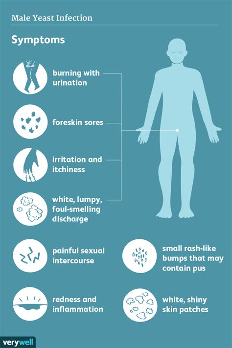 Male Yeast Infection Causes And Symptoms