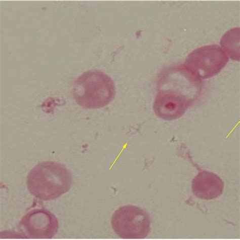 Photomicrograph Of Gram Stain Demonstrates Gram Negative Spiral Rods