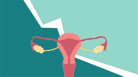 Endometriosis 5 Signs You Might Have Endometriosis • Tasteandcraze
