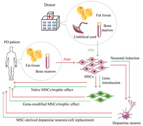 Mesenchymal Stem Cell Based Therapy For Parkinsons Disease