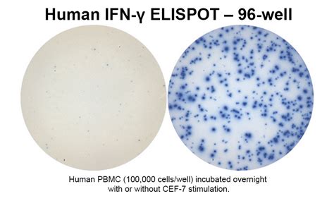 Human IFN γ Single Color ELISPOT ImmunoSpot