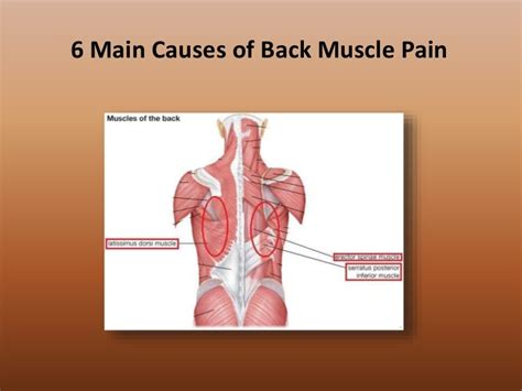 6 Main Causes Of Back Muscle Pain