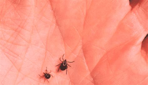 This Ticks Bite Can Make You Allergic To Red Meatand Its Spreading