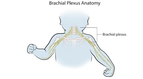 Filing A Brachial Plexus Birth Injury Lawsuit 7 Ultimate Steps The