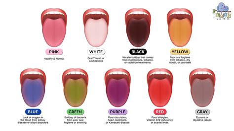 Use This Tongue Color Chart To Understand Your Health