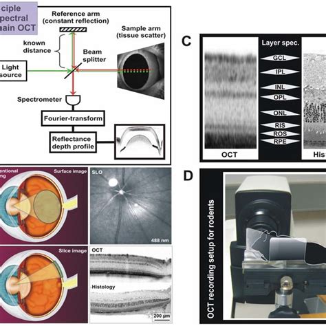 Principle Of Optical Coherence Tomography Oct And Its Application In