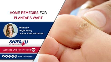 home remedies for plantar warts