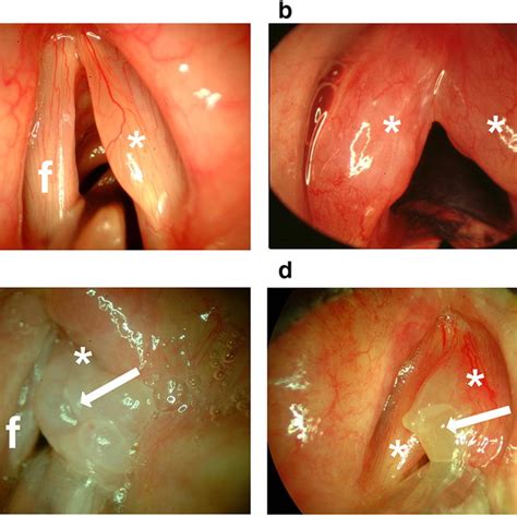 Simple Science: How to Make a Volcano with Kids