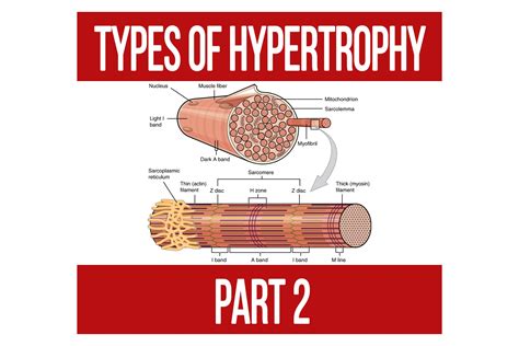 Types Of Hypertrophy Part 2 N1 Training
