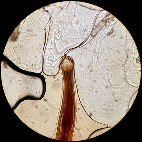 Ancylostoma Caninum Fondos De Dibujos Animados Microbiología