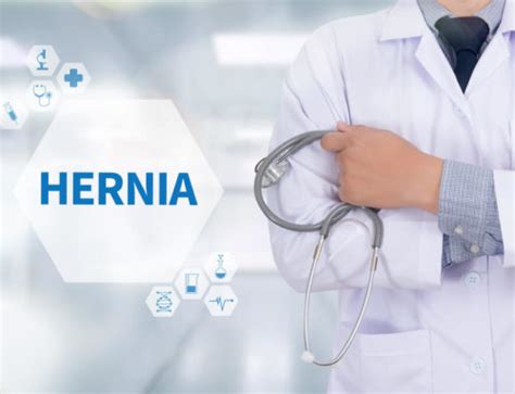 Inguinal Hernia Symptoms Risk Factors And Surgery Advanced Surgical