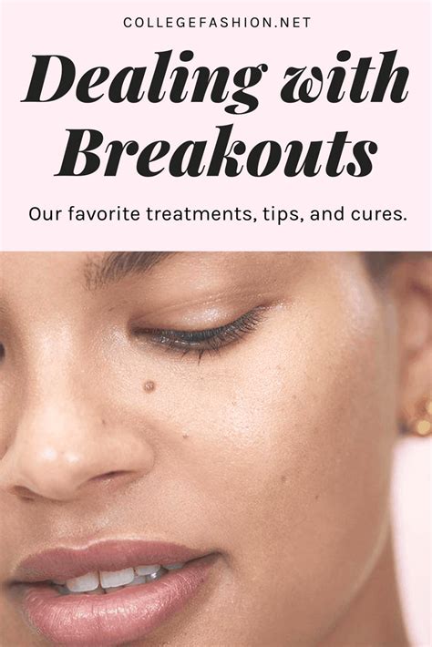 A Step By Step Guide To Dealing With Skin Breakouts College Fashion