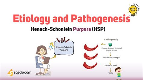 Henoch Schonlein Purpura Hsp Case Study