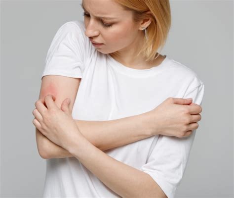 Dermatite Atopica cos è perché si manifesta sintomi e cure
