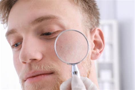 Dermatologist Examining Patient With Magnifying Glass In Clinic Stock