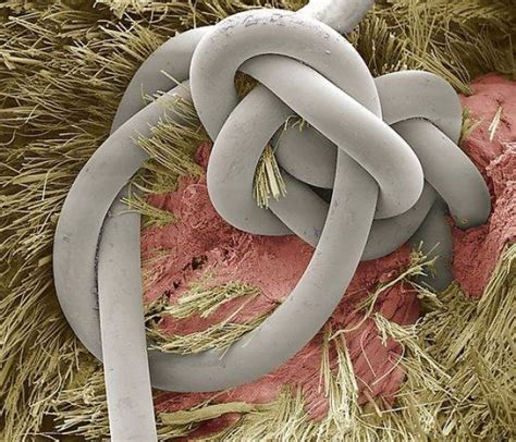 Cool Photos Of The Amazing And Bizarre World Under A Microscope