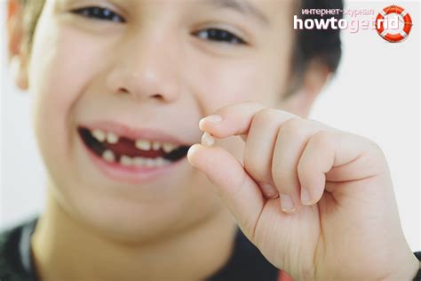 Zub koji je traumatiziran i pomičan fiksira se tzv. Как вырвать зуб ребенку в домашних условиях