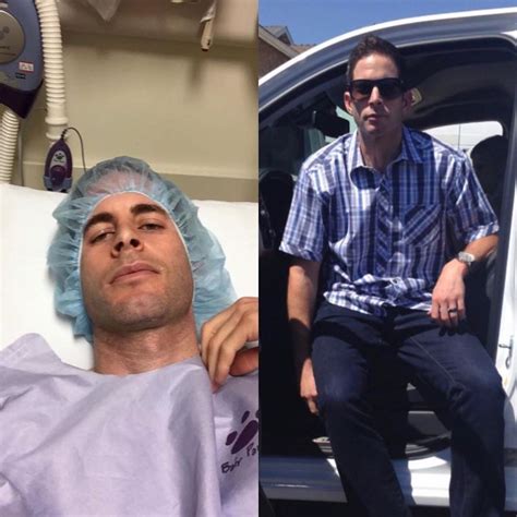 Tarek El Moussa Shares Before And After Photos After Beating Cancer