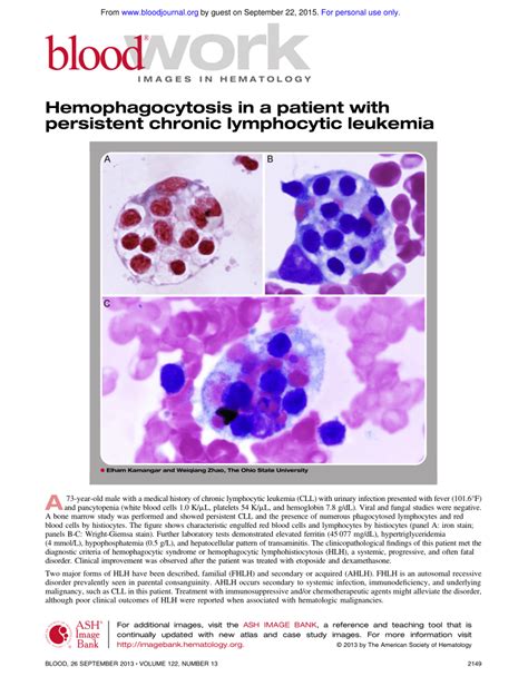 Pdf Hemophagocytosis In A Patient With Persistent Chronic Lymphocytic