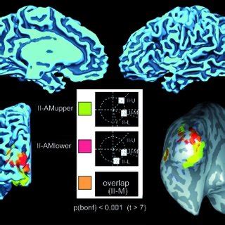 Group Level FMRI Results Group Level FMRI Activations In Conditions