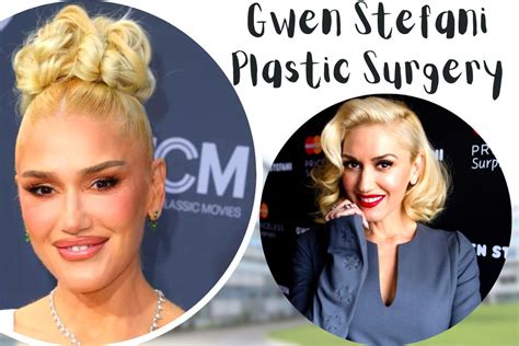 California Native Gwen Stefani Plastic Surgery How She Got A Face Lift