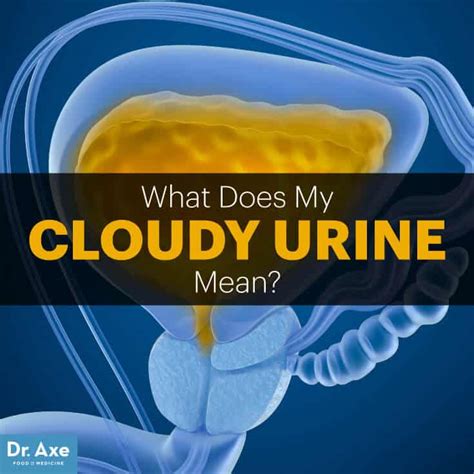 Normal urine color ranges from pale yellow to deep amber — the result of a pigment called urochrome and how diluted or concentrated the urine is. What You Need to Know About Cloudy Urine: Causes, Issues ...