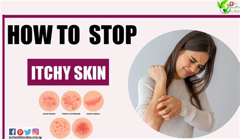 How To Stop Itchy Skin 8 Steps