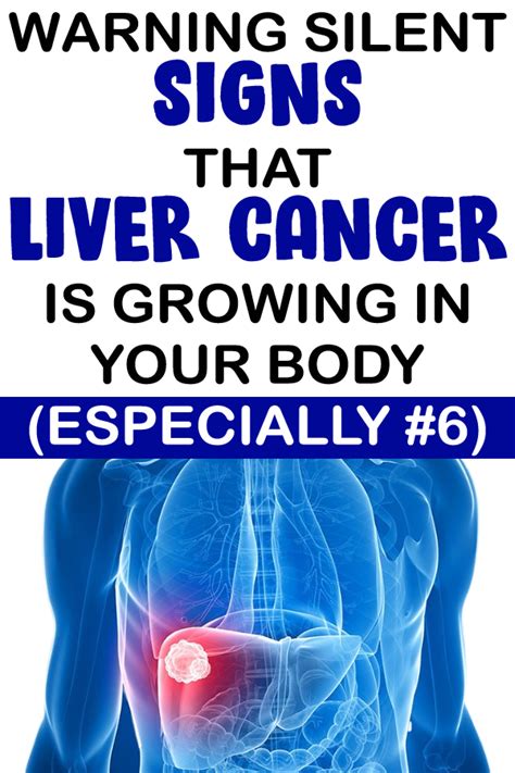 8 Silent Signs Of Liver Cancer You Should Not Ignore