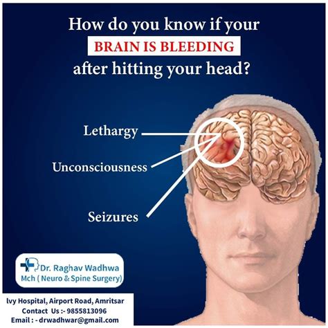 Headache After Brain Surgery Headache