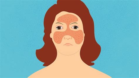 Pin On Skin Symptoms