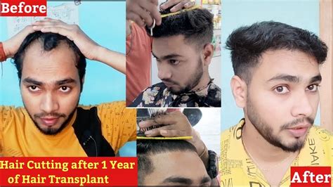 Haircut After Year Of Hair Transplant Hair Transplant Result Ganesh Thakur YouTube