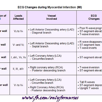 What does an ekg look like in a heart attack. EKG Changes | Icu nursing, Medical graduate, Nursing mnemonics