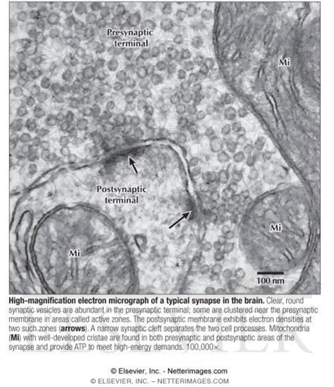 High Magnification Electron Micrograph Of A Typical Synapse In The Brain