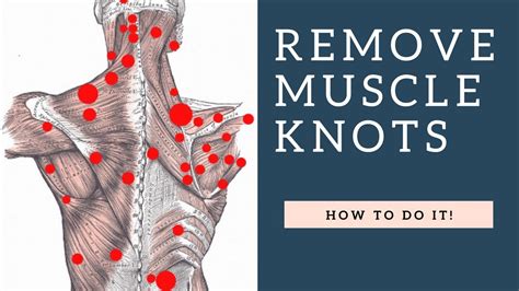 The following strengthening exercises will stabilize the muscles between and around your shoulder blades. BEST Way To Fix Shoulder Knots / Myofascial Trigger Points ...