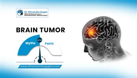 7 Brain Tumor Myths And Facts Dr Himanshu Gupta