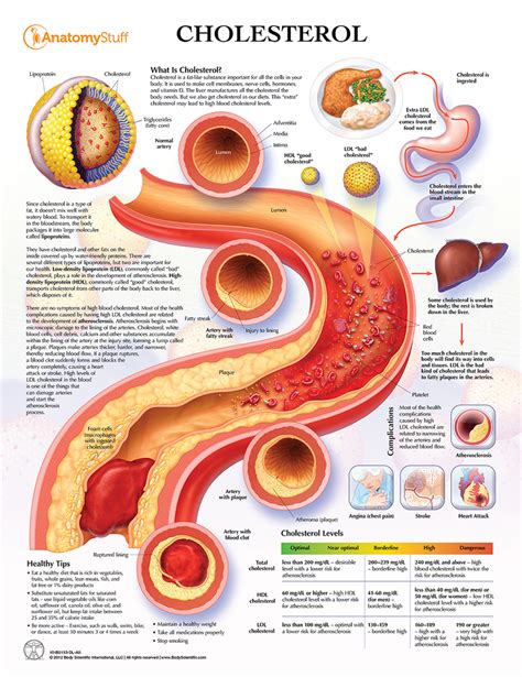 Cholesterol Understanding Ldl And Hdl Chart Poster Laminated Ldl100