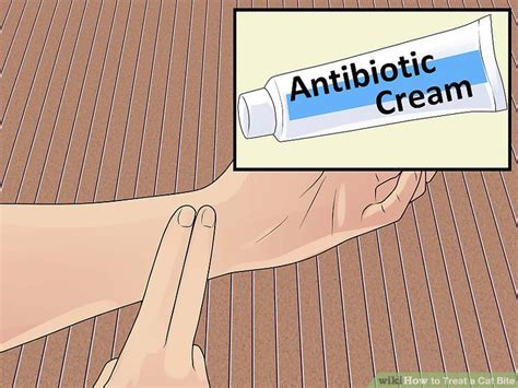 How to treat a cat bite. How to Treat a Cat Bite: 14 Steps (with Pictures) - wikiHow