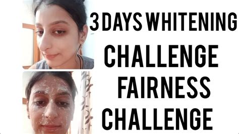 Get Clear Skin In 3 Days Skin Whitening Home Remedy For Clear And