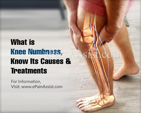 What Is Knee Numbness Know Its Causes And Treatments