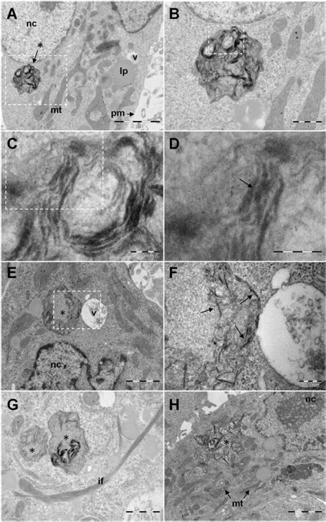 Intracellular Fate Of Cxyg Nanoplatelets Images A B C And D Show Sem
