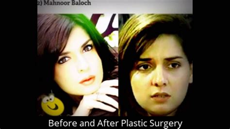 Watch Pictures Of Pakistani Actresses Before And After Plastic Surgery Video Youtube