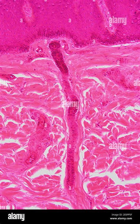 Human Skin Showing Epidermis And Dermis With Sweat Glands And