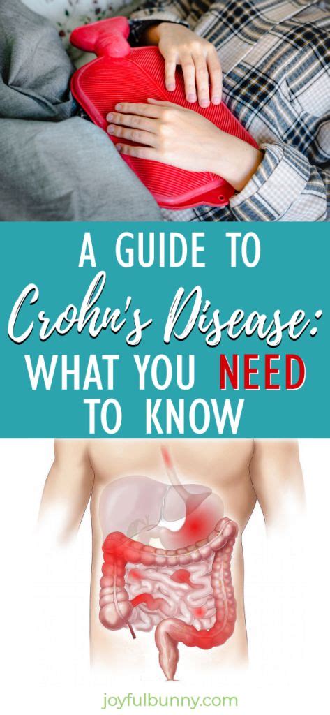 A Guide To Crohn S Disease What You Need To Know In Crohns Disease Crohns Crohns