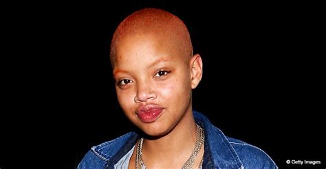 Slick Woods From Love And Hip Hop Hollywood Reveals She Is Undergoing
