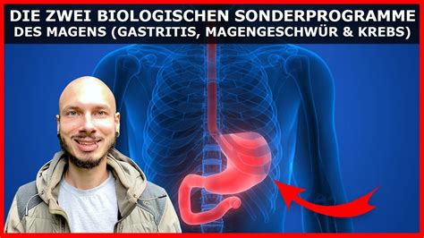 Gastritis MagengeschwÜr Und Magenkrebs Das Steckt Wirklich Hinter Diesen Diagnosen Youtube