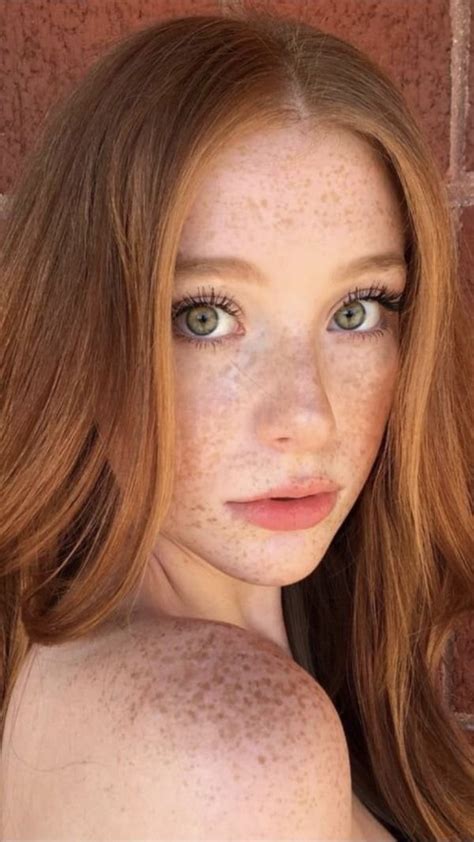 girls with freckles 32 pics